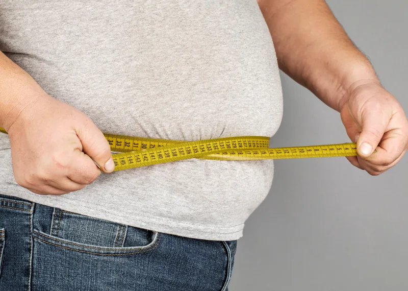 Obesity